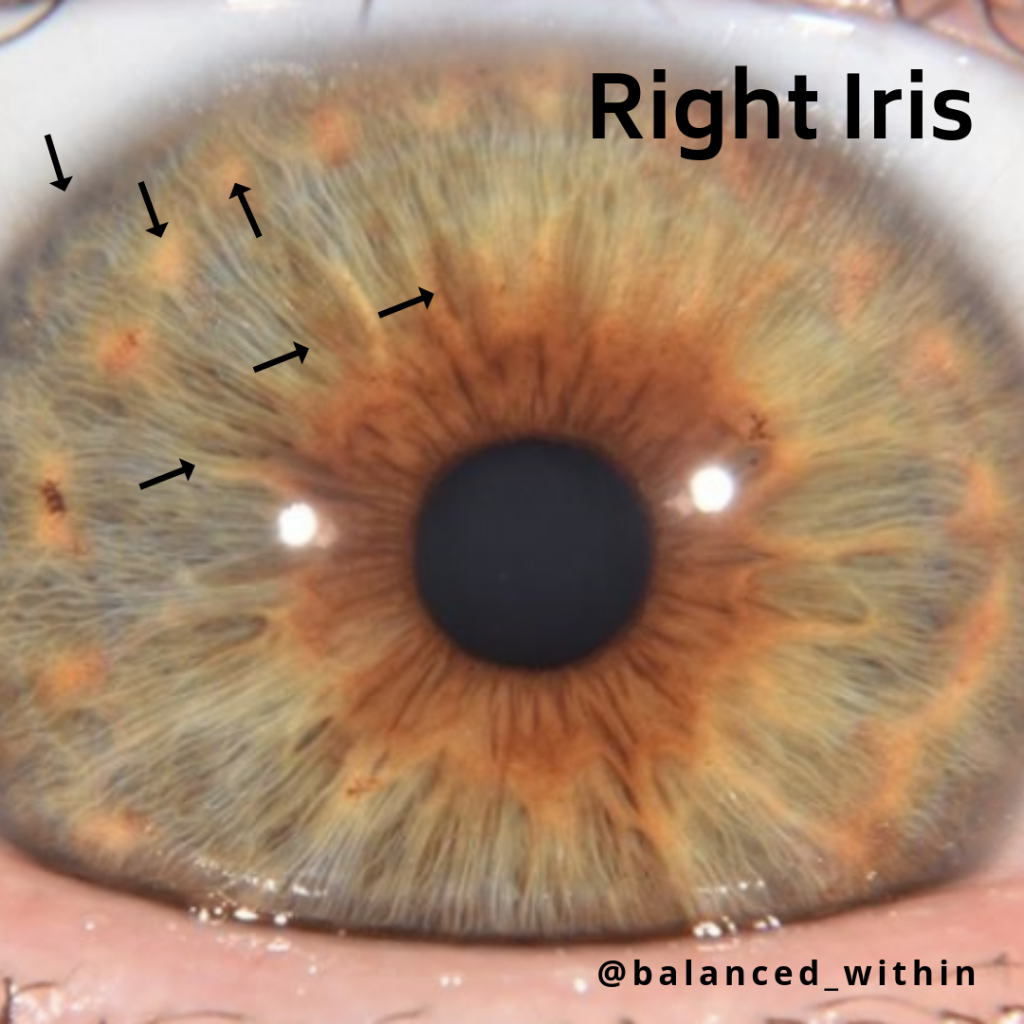 Iris 1024x1024 - What Iridology Can Reveal?