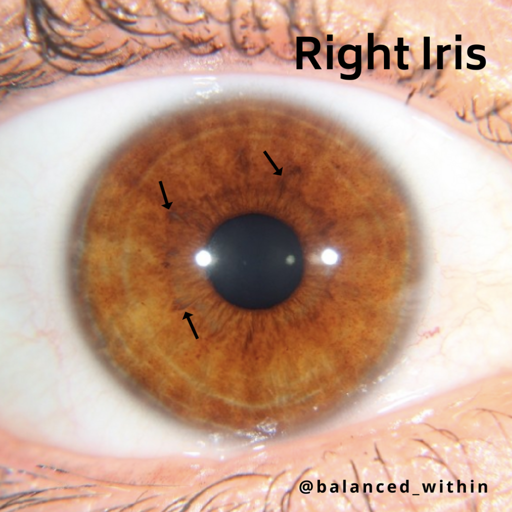 iris indication 1024x1024 - What Iridology Can Reveal?